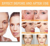 ORDINARY Glycolic 7% Solution for Blemishes, Acne, Wrinkles & Toning Resurfacing 240ml