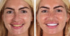 Probiotic Whitening Toothpaste